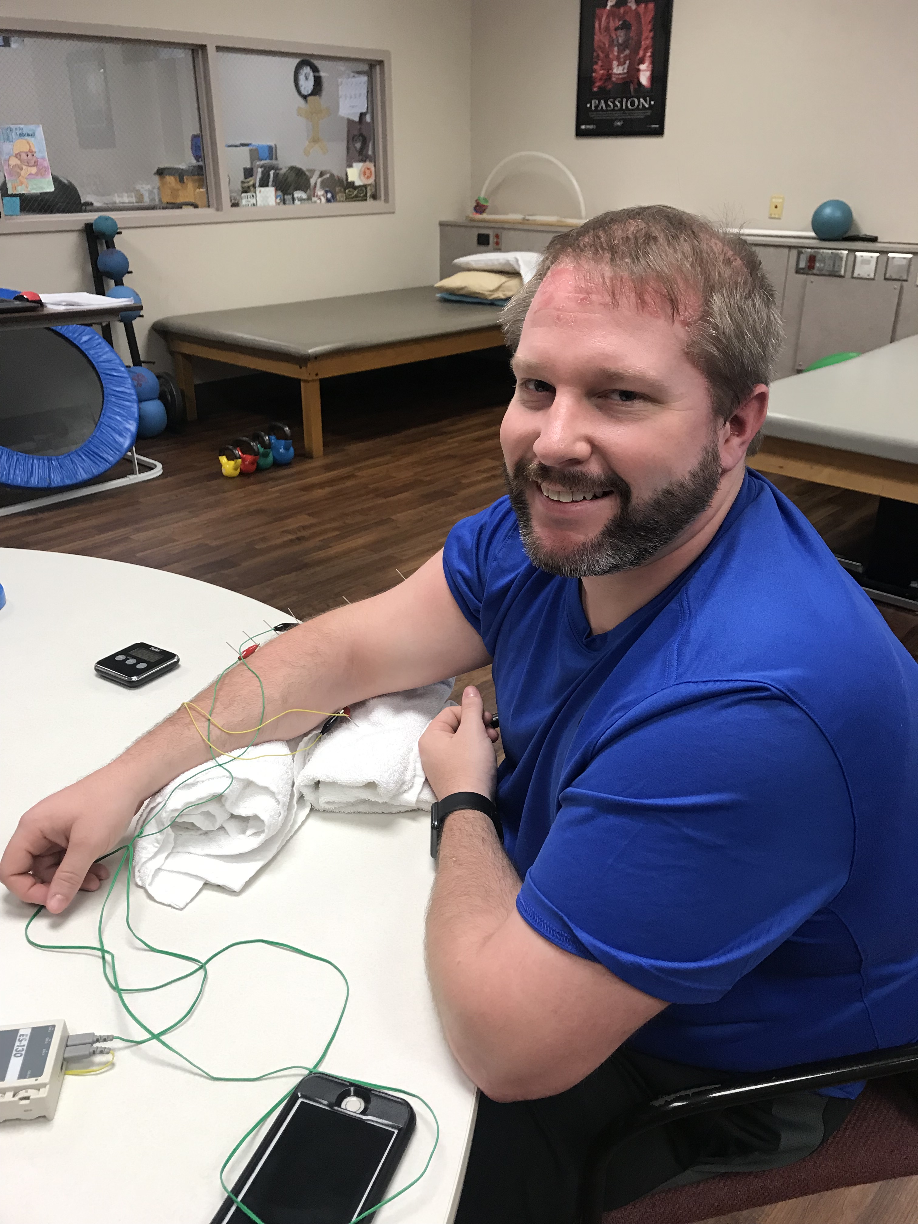 Max Weeks receiving Dry Needling treatment at Encore Rehabilitation-Bessemer West #EncoreRehab