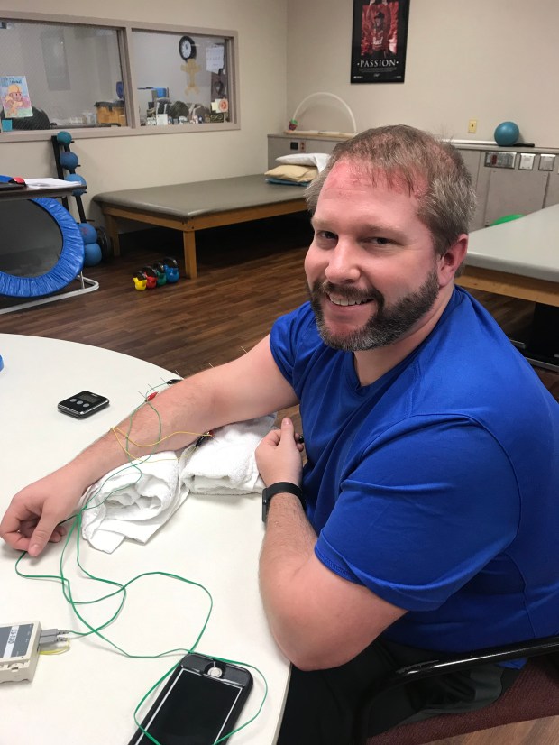Max Weeks receiving Dry Needling treatment at Encore Rehabilitation-Bessemer West #EncoreRehab