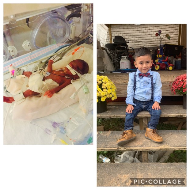 Jayden is celebrating National Prematurity Awareness Month with #EncoreRehab - Cullman